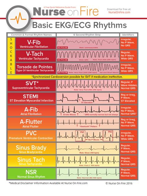 free printable ekg cheat sheet.